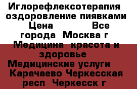 Иглорефлексотерапия, оздоровление пиявками › Цена ­ 3 000 - Все города, Москва г. Медицина, красота и здоровье » Медицинские услуги   . Карачаево-Черкесская респ.,Черкесск г.